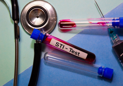 Understanding the Significance of Regular STI Testing