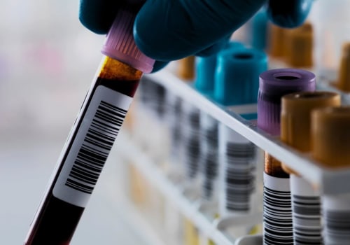 Understanding the Diagnosis and Evaluation of Erectile Dysfunction